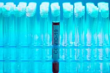 File photo courtesy of © Can Stock Photo / shmeljov
