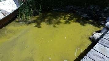 Blue-Green algae bloom in Lake Rosalind, north of Hanover. (Photo contributed by Grey-Bruce Health Unit).